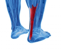 Possible Causes and Symptoms of an Achilles Tendon Injury