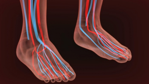 What Are Systemic Diseases of the Foot?