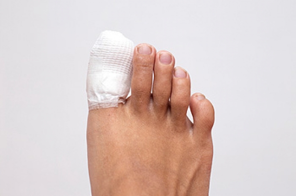Could My Stubbed Toe Be Broken?