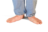 Risks of Having Flat Feet